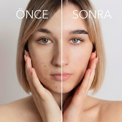 Waterfall™ Filtreli Musluk Başlığı