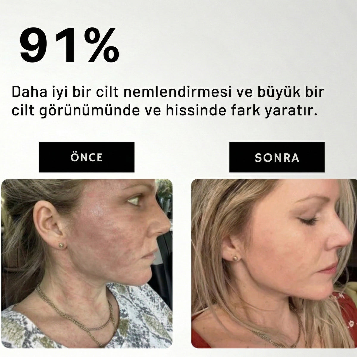 Waterfall™ Filtreli Duş Başlığı