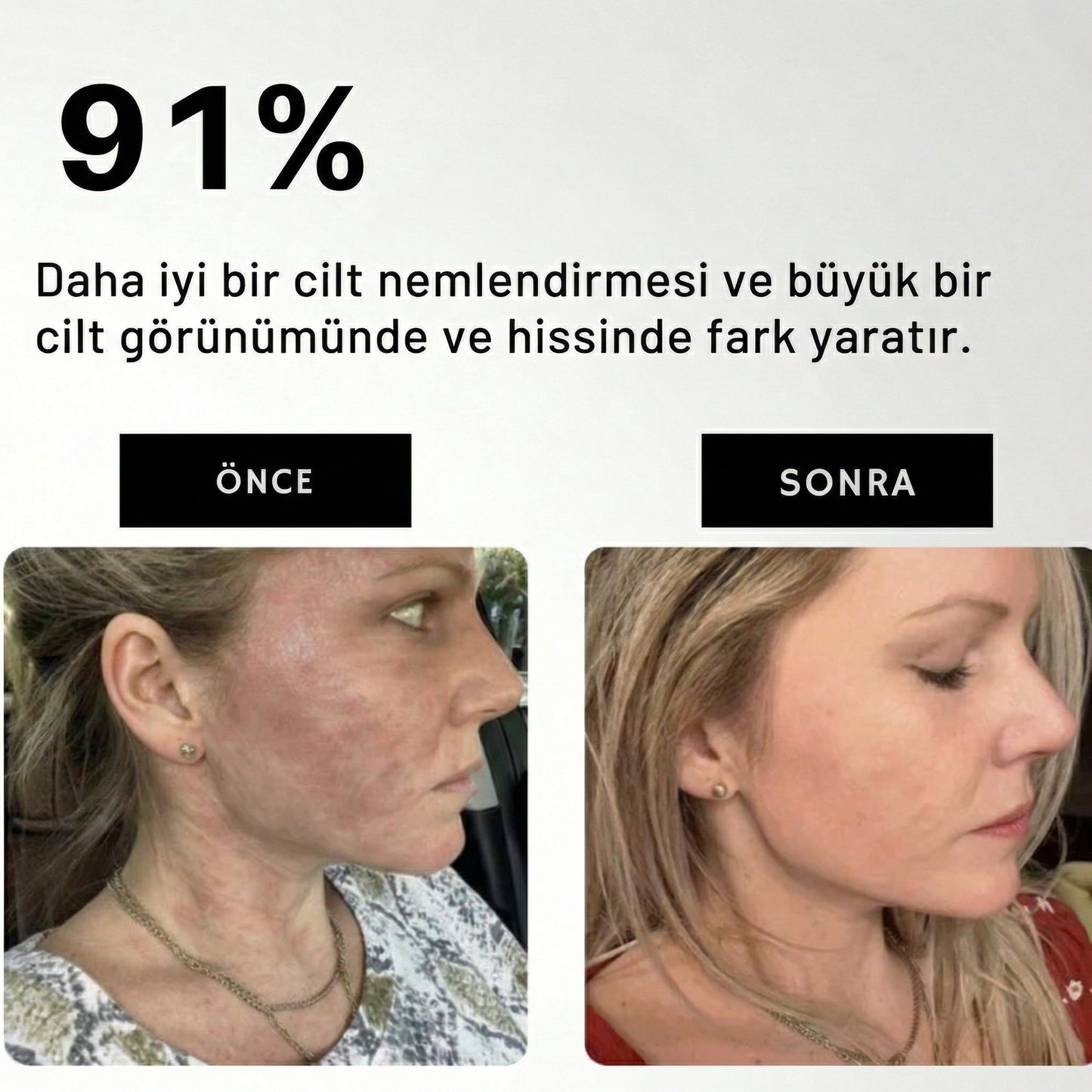 Waterfall™ Filtreli Duş Başlığı